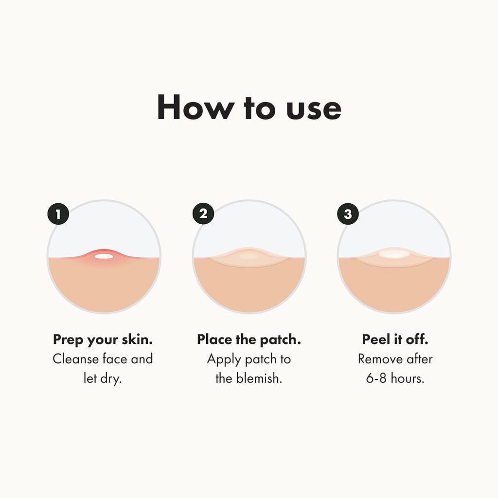 ™ Original Patch from Hero Cosmetics – the #1 Hydrocolloid Acne Pimple Patch for Shrinking Zits and Whiteheads in 1 Use; Nighttime Spot Stickers for Face and Skin (36 Count)