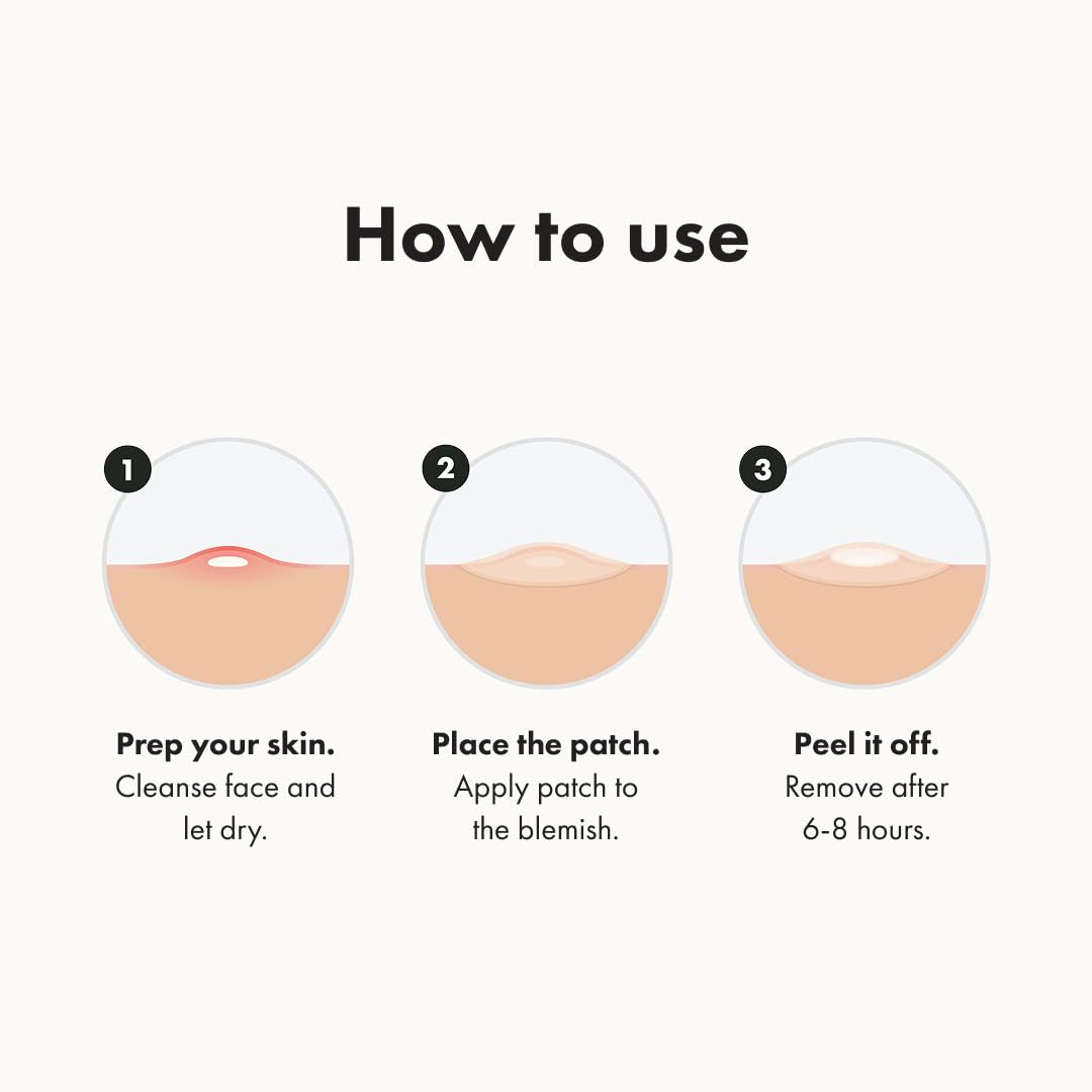 ™ Original Patch from Hero Cosmetics – the #1 Hydrocolloid Acne Pimple Patch for Shrinking Zits and Whiteheads in 1 Use; Nighttime Spot Stickers for Face and Skin (36 Count)